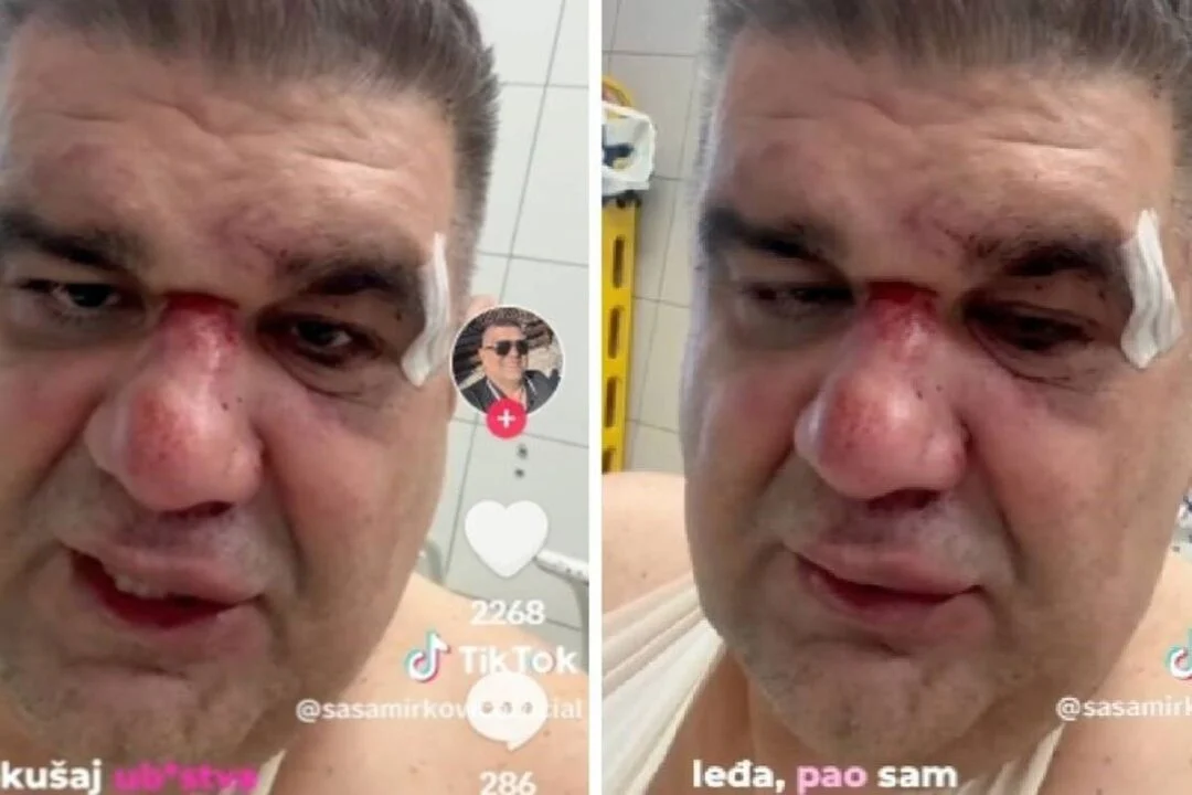 jajce-online_Mirković se oglasio nakon brutalnog prebijanja u Zagrebu: Niko iz hotela nije izašao