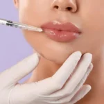 jajce-online_Botox i fileri bez nadzora: Ekspanzija opasnih tretmana u BiH