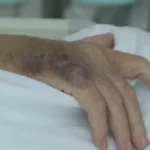 jajce-online_Pacijenti u FBiH bez terapija koje spašavaju život: Nedopustiv nemar i društvena sramota