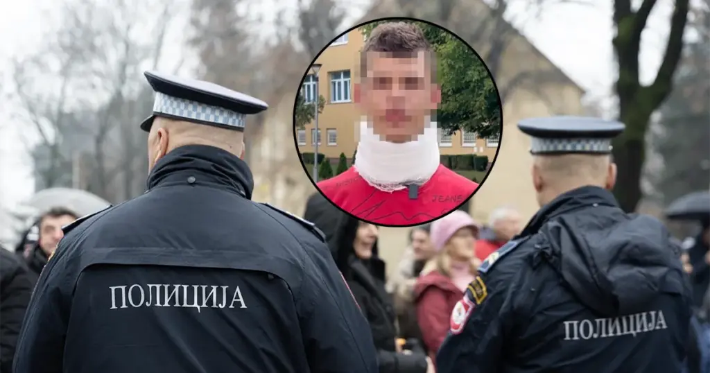 jajce-online_Lomili prste dječaku Ajdinu: Dva policajca saznala kaznu za nasilje, dvojica se izvukla bez sankcija